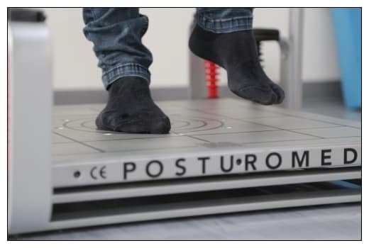 Diese 5 Therapien helfen dir 2 Gleichgewicht verbessern -eine unserer Spezialisierungen